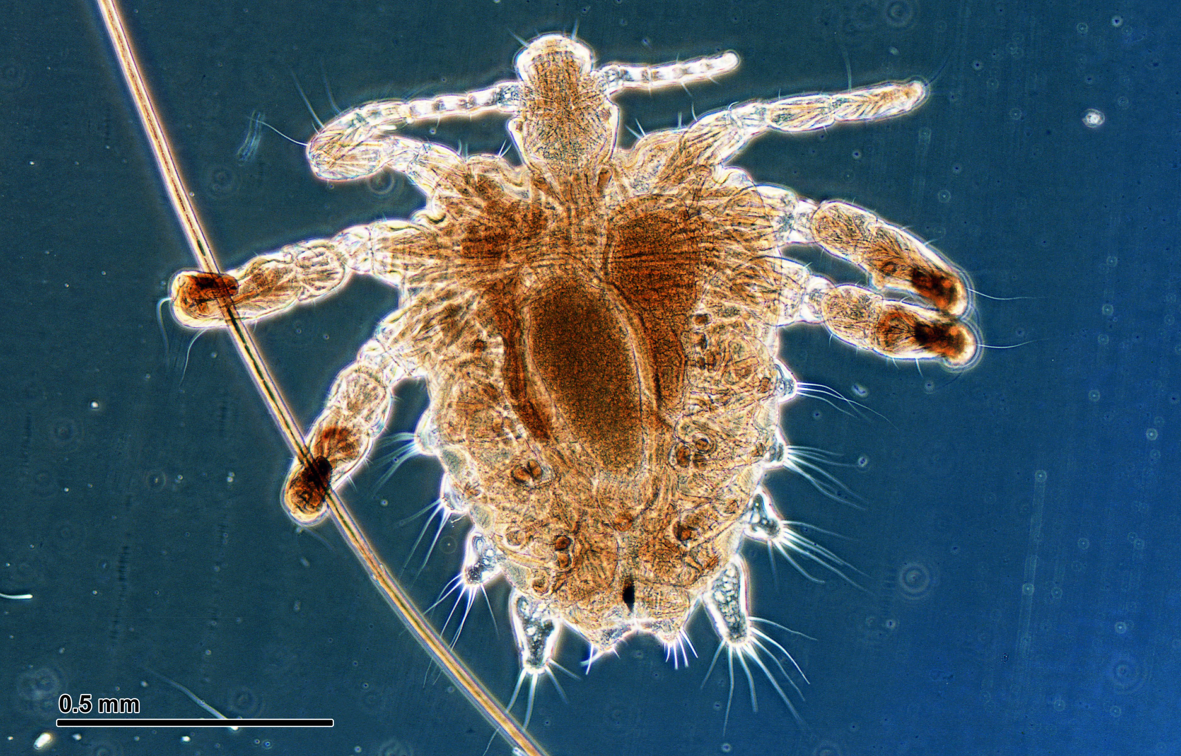 a Crab louse under a microscope