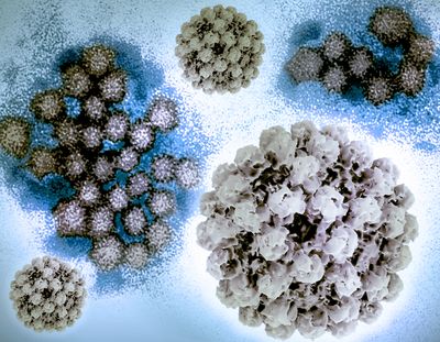 Creative layout featuring 3D renderings of norovirus structures, generated from electron microscopy (top center and bottom left and right), and a transmission electron micrograph of norovirus particles in the background. 3D renderings of norovirus VLPs by NIH 3D (3dprint.nih.gov); transmission electron micrograph—which has been repositioned and colored by NIAID—is courtesy of CDC. Note: not to scale.