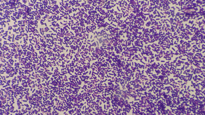 E. coli under a microscope.