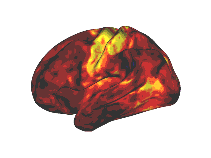 WashU Medicine researchers find stimulant medications don’t affect attention-controlling regions of the brain, as previously thought. Brain scans show the drugs affect brain areas involved in wakefulness and reward, highlighted in yellow and orange.