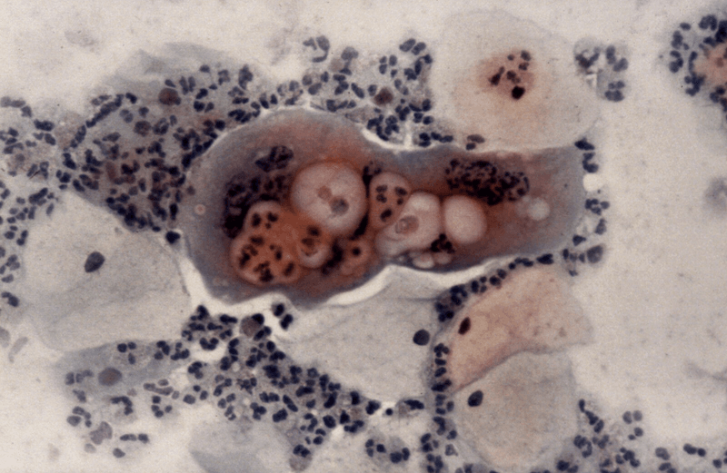 Herpes virus under a microscope.