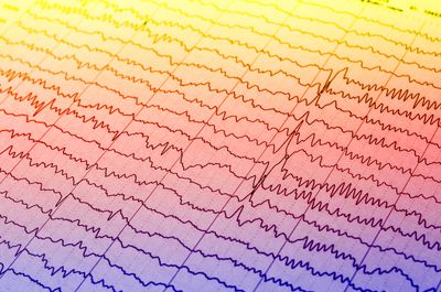 EEG readout on an ombre background from yellow at the top through pink to lilac at the bottom