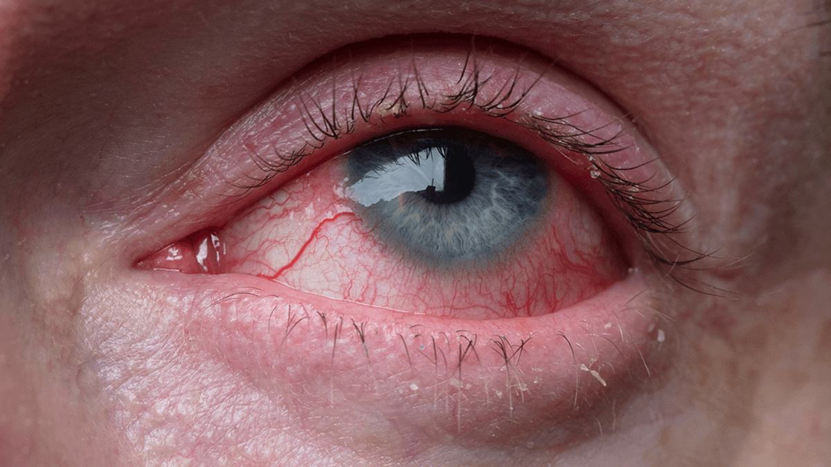 In 1963 Randy Gardner Flipped A Coin And Became The Most Sleep-Deprived Person In History