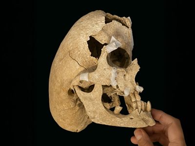 The photo shows the reconstructed knight's skull. The skull is positioned in profile looking to the right and you can clearly see the strange narrowed shape of its cranium which gives it a scrunched up look.