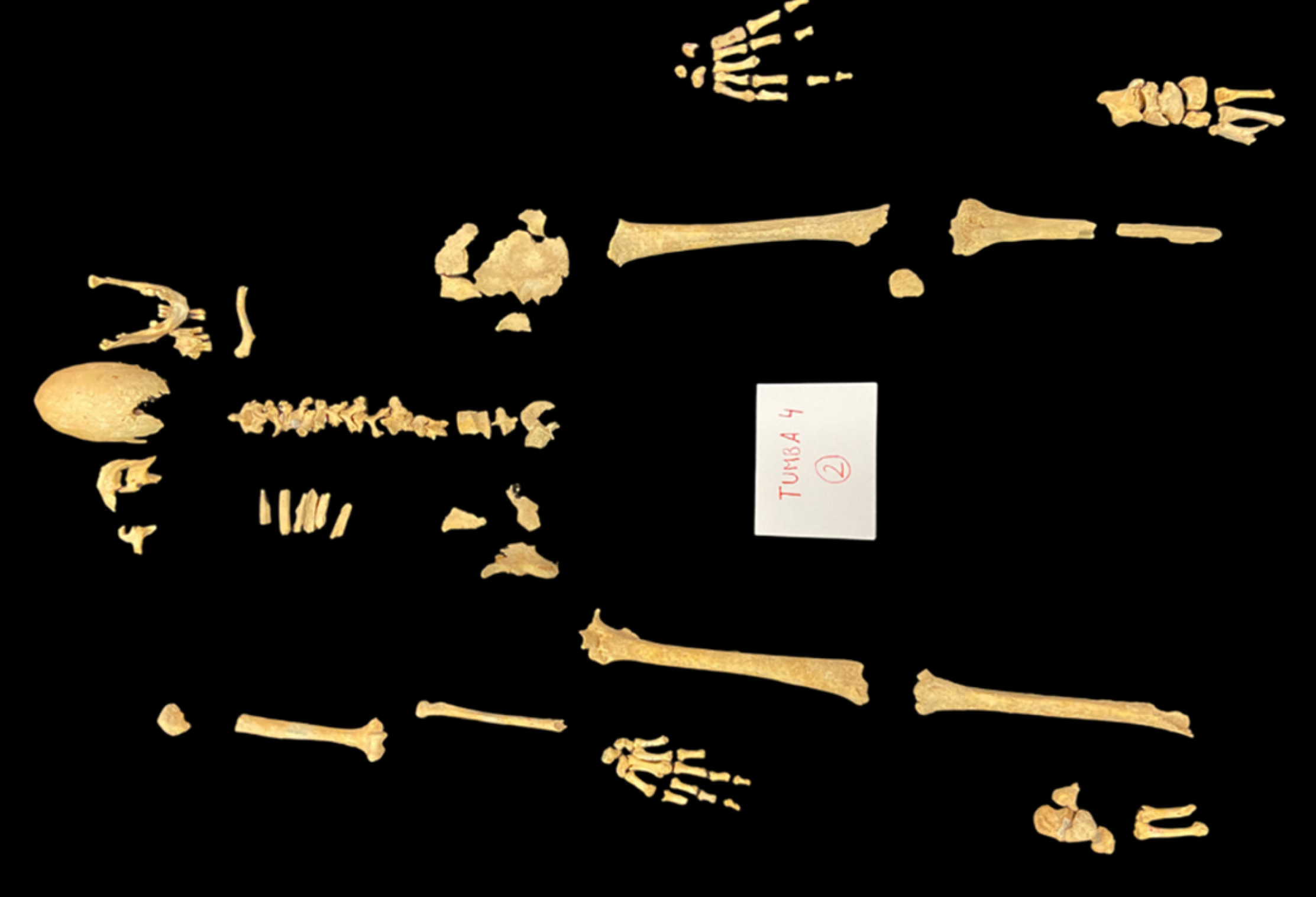 The bones of the presumed knight are laid out on a black background. The bones of the presumed knight are laid out on a black background.