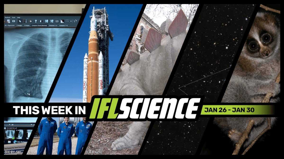 Patient Survives For Incredible 48 Hours Without Lungs, The Real Size Of Artemis II's Orion Capsule, And Much More This Week