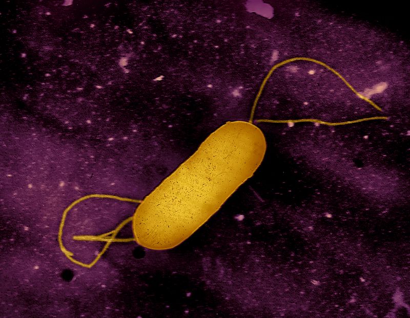 Colorized transmission electron micrograph of a flagellated Listeria bacterium. This pathogen causes the food borne illness listeriosis. Microscopy by CDC; colorization and visual effects by NIAID