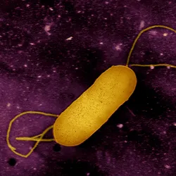 Colorized transmission electron micrograph of a flagellated Listeria bacterium. This pathogen causes the food borne illness listeriosis. Microscopy by CDC; colorization and visual effects by NIAID