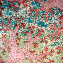 A stunning photograph of a pink cauliflower coral looking up at the blue sea. The branches of the coral look like trees and the blue looks like the sky full of stars.