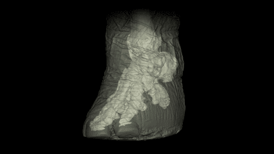 Reconstructed CT scan of elephant foot shows it on tippy toes