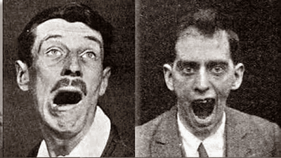 Patients with Encephalitis lethargica.