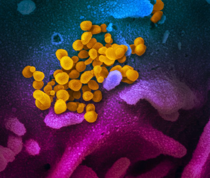 This scanning electron microscope image shows SARS-CoV-2 (in yellow), the virus that causes COVID-19, emerging from the surface of laboratory-grown cells (blue / pink).