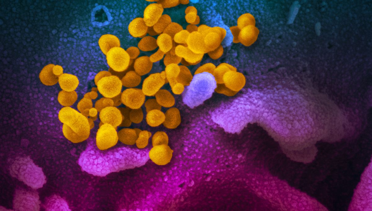 SARS-CoV-2 ウイルスは、感染から回復した人でも脳の微細構造と化学変化を引き起こす可能性がある