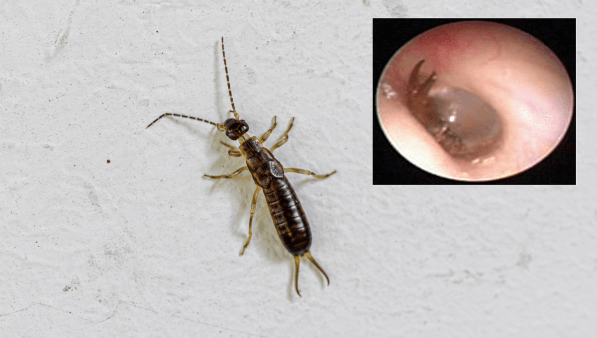 Do Earwigs Go In Your Ear? Sometimes, Yes (But They Don’t Eat Your ...