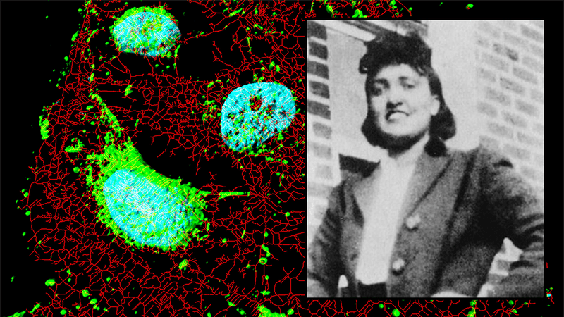 Henrietta Lacks, and the HeLa immortal cell line.