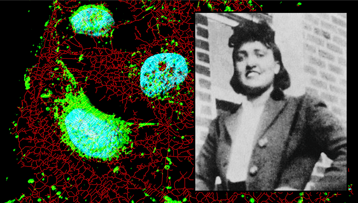 Henrietta Lacks' Family Gets Undisclosed Settlement In "Immortal Cells" Case - IFLScience