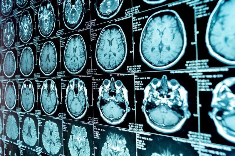 brain MRI images in a grid