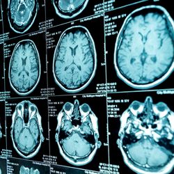 brain MRI images in a grid