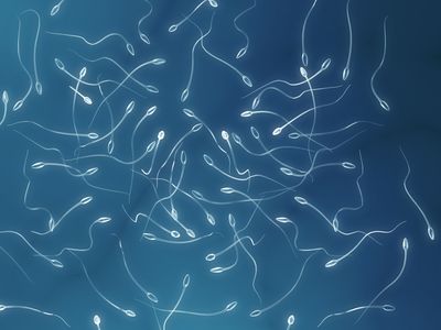 A digital photo showing sperm cells clustered together on a blue background. 