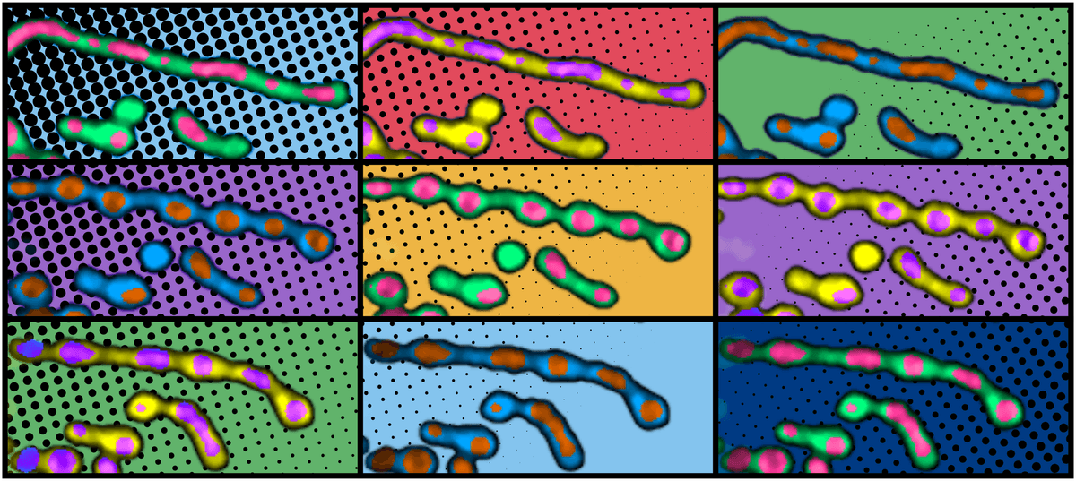 “Why Did This Evolve? It Didn’t. It Was Already There”: 100-Year-Old Mystery Of Why Mitochondria Sometimes Look Like Strings Of Pearls Finally Solved