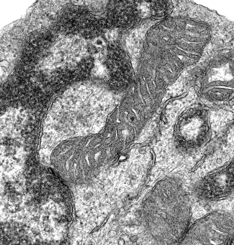 Transmission electron microscope close-up of mitochondria in normal cell. Transmission electron microscope close-up of mitochondria in normal cell.
