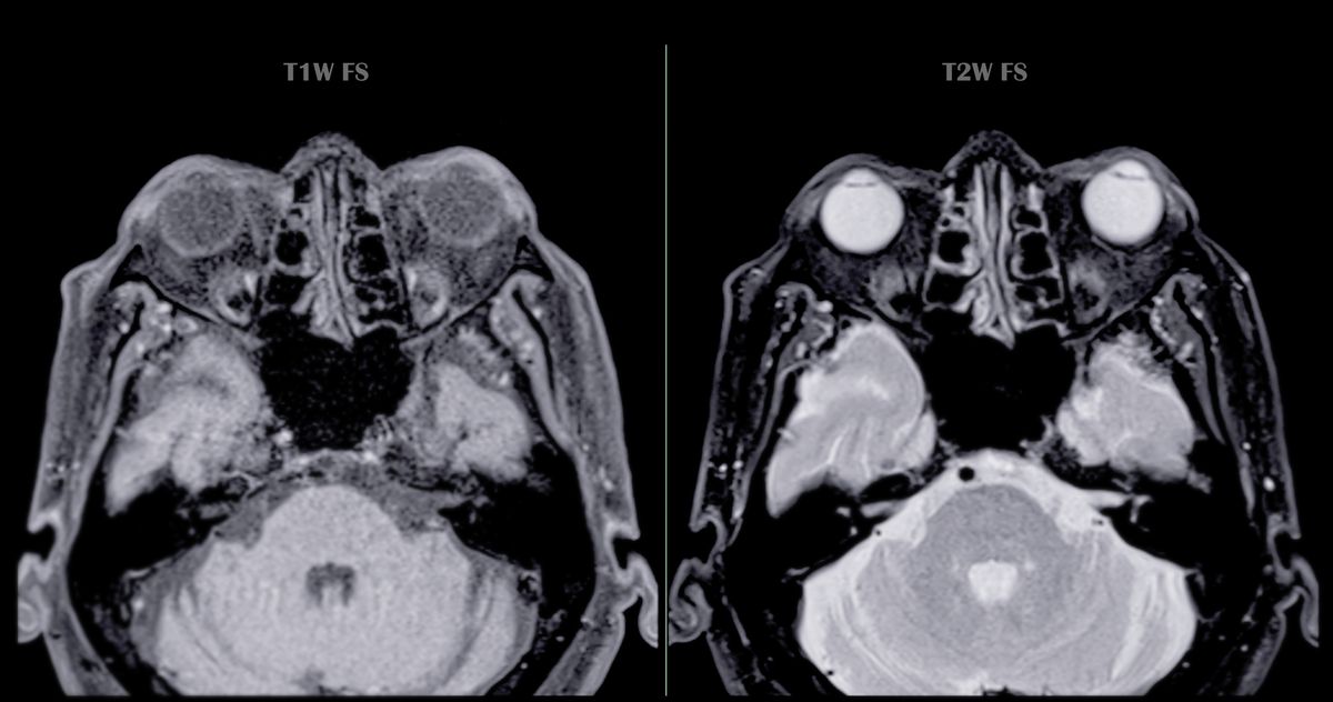 The McCollough Effect: A Trippy Optical Illusion That Can Lock Into Your Brain For 85 Days