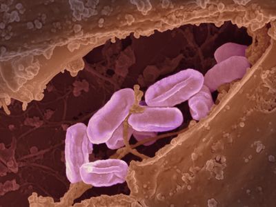 Scanning electron micrograph of Rickettsia typhi bacteria. Image captured at NIAID's Rocky Mountain Laboratories (RML) in Hamilton, Montana