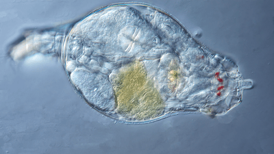 Bdelloid rotifer under a microscope.