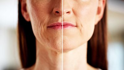 A photo of a woman's face with a line going through the center. The line demarcates a slight age difference in each half. On the left, the woman's face has more wrinkles and looks older, but on the right there is more light and her skin is smoother.