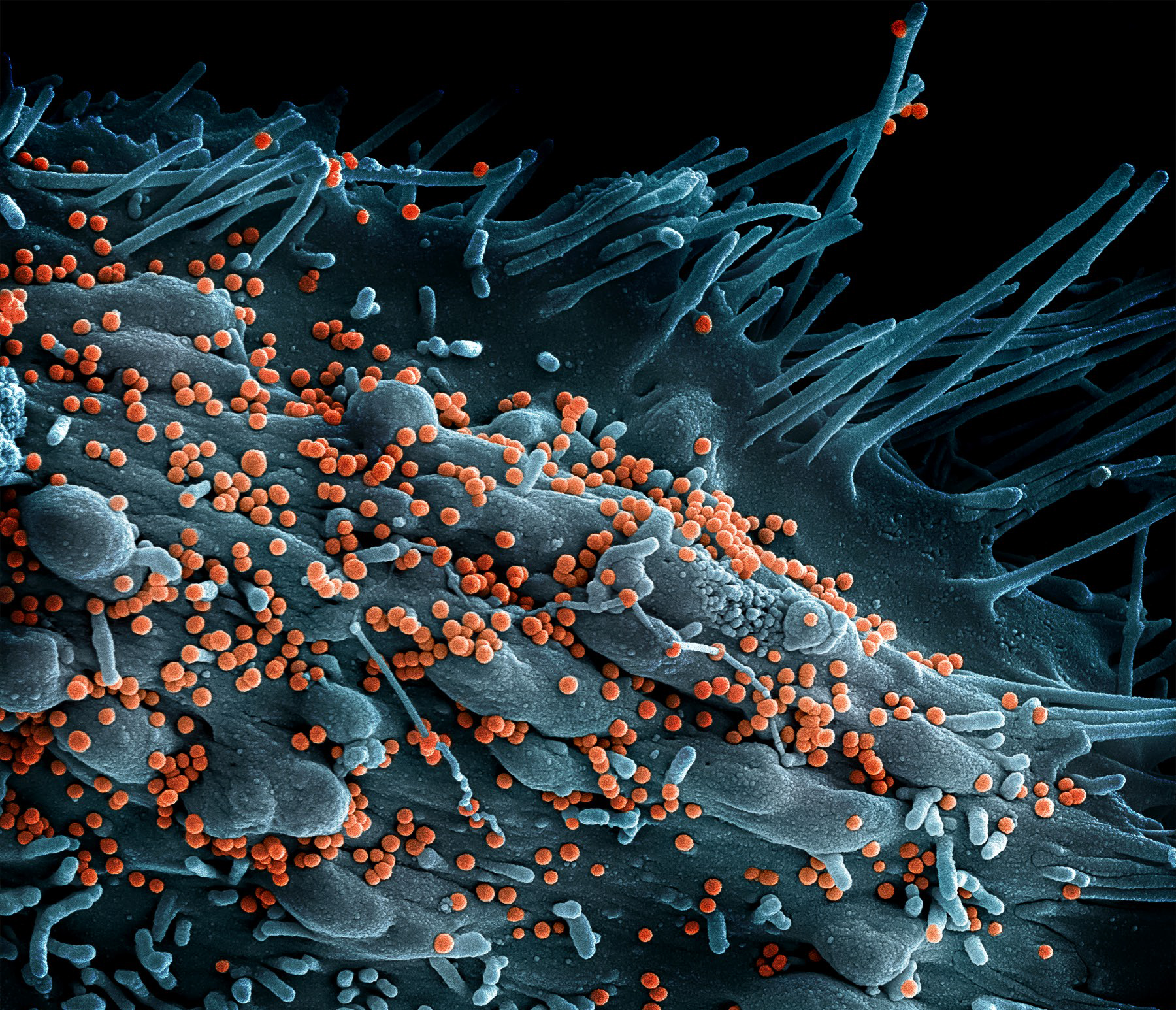 Scanning electron micrograph of Lassa virus budding off a cell. Lassa virus (LASV) is an arenavirus that causes Lassa hemorrhagic fever, a type of viral hemorrhagic fever (VHF) in humans and other primates. Image captured and colorized at the NIAID Integrated Research Facility (IRF) in Fort Detrick, Maryland. 
