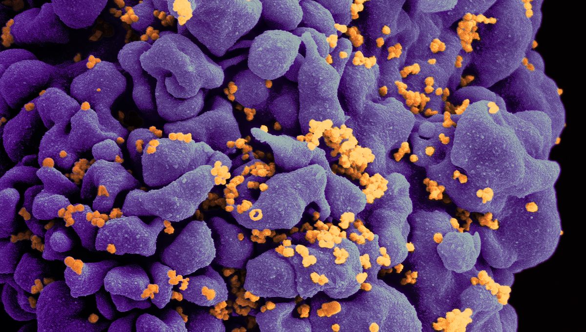 HIV Was Quietly Influencing Human Evolution. Antiretroviral Therapy ...
