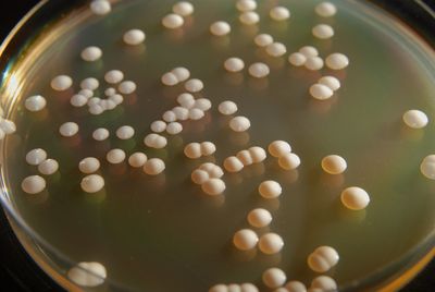 Individual colonies of Saccharomyces cerevisiae yeast growing on solid YPD nutrient medim