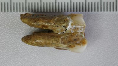 Image of a tooth from the Zhoukoudian site.