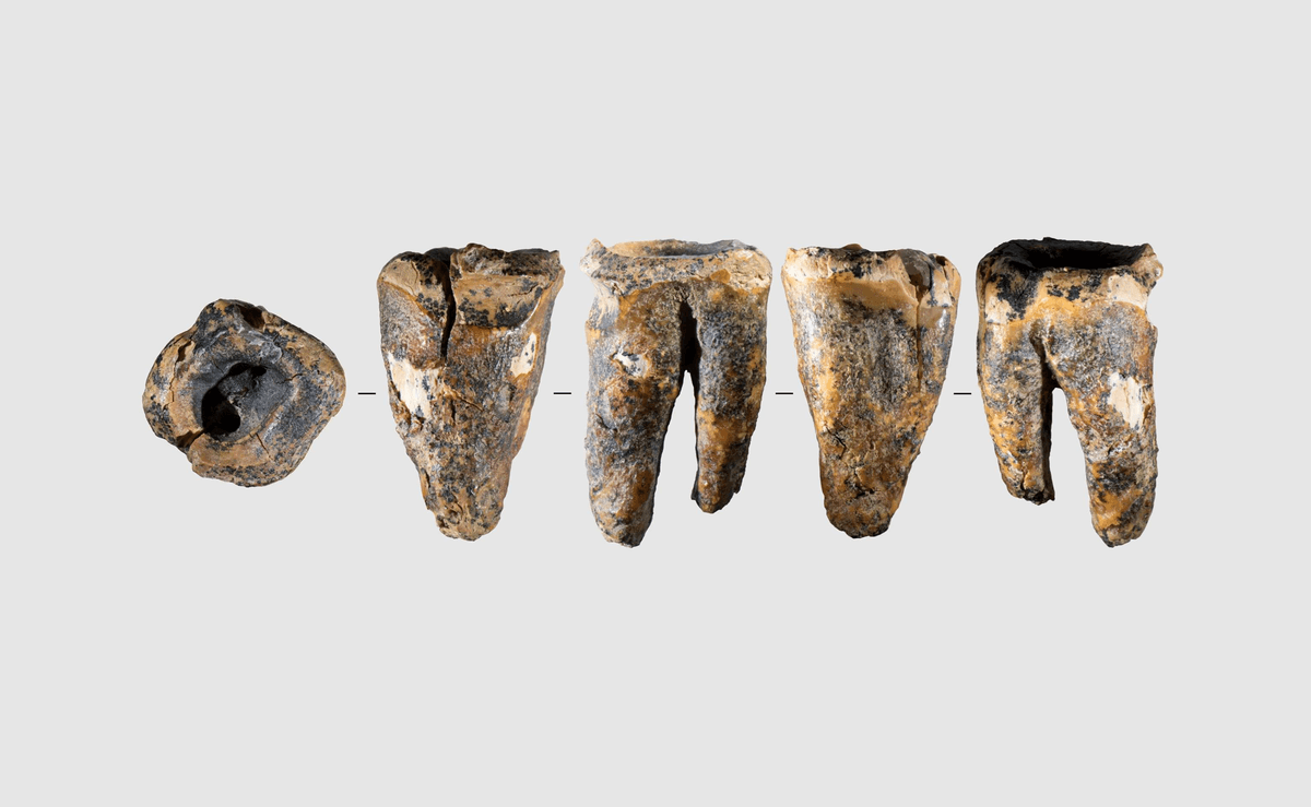Neanderthals Were Performing Dental Surgery Nearly 60,000 Years Ago – And It Actually Worked