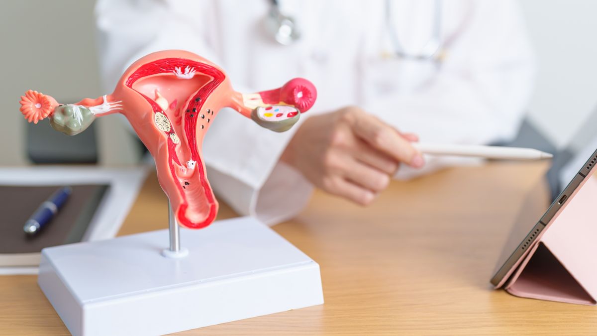 PCOS Has A New Name: Meet PMOS. Here’s What To Know About Why It’s Been Changed