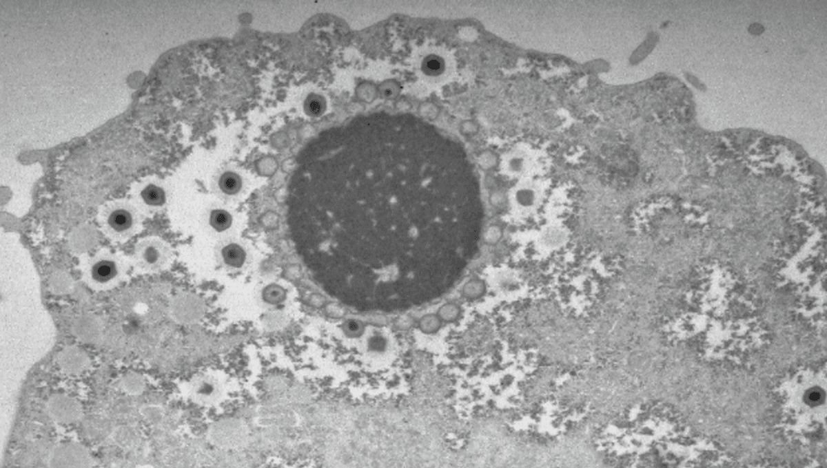Newly Discovered Giant Virus Replicates In A Unique Way, Hinting At ...