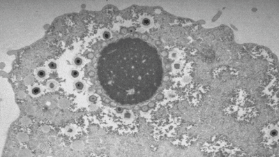 Transmission electron microscopy shows mimivirus production inside an amoeba