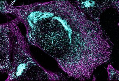 Microtubules (magenta) and tau protein (light blue) in a cell model of tauopathy. Researchers believe that tauopathy—the aggregation of tau protein—plays a role in Alzheimer’s disease and other neurodegenerative diseases. This image was captured using Stochastic Optical Reconstruction Microscopy (STORM).