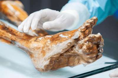 The feet of Otzi the iceman being examined by a scientists 