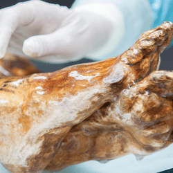 The feet of Otzi the iceman being examined by a scientists