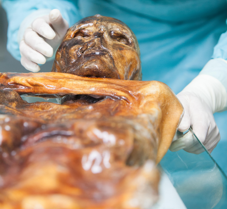 Ötzi the iceman mummy