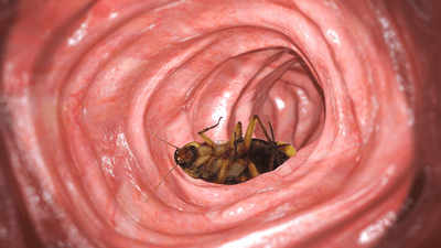 a cockroach sits in a generated image of a colonoscopy to look like it's in the colon