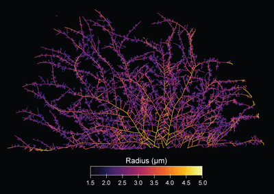 An image of a Mycelial network digitally colored to show its extension. It is made up of purple connections expanding in various directions, with the thicker shoots having a more yellow color.