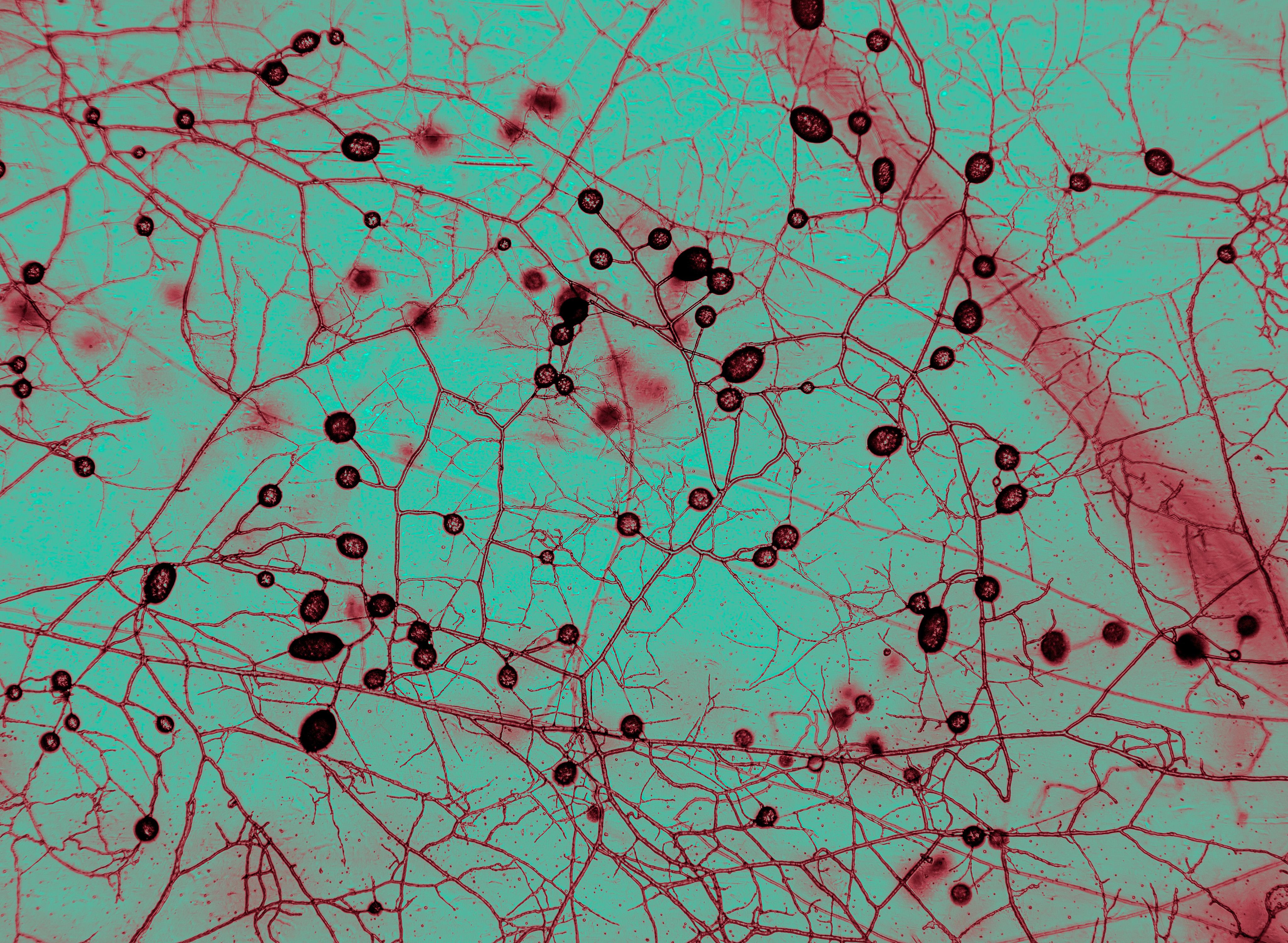 Mycorrizhal fungi under the microscope at AMOLF biophysics institute in Amsterdam. The circular structures are spores. Color is altered for legibility. Mycorrizhal fungi under the microscope at AMOLF biophysics institute in Amsterdam. The circular structures are spores. Color is altered for legibility.