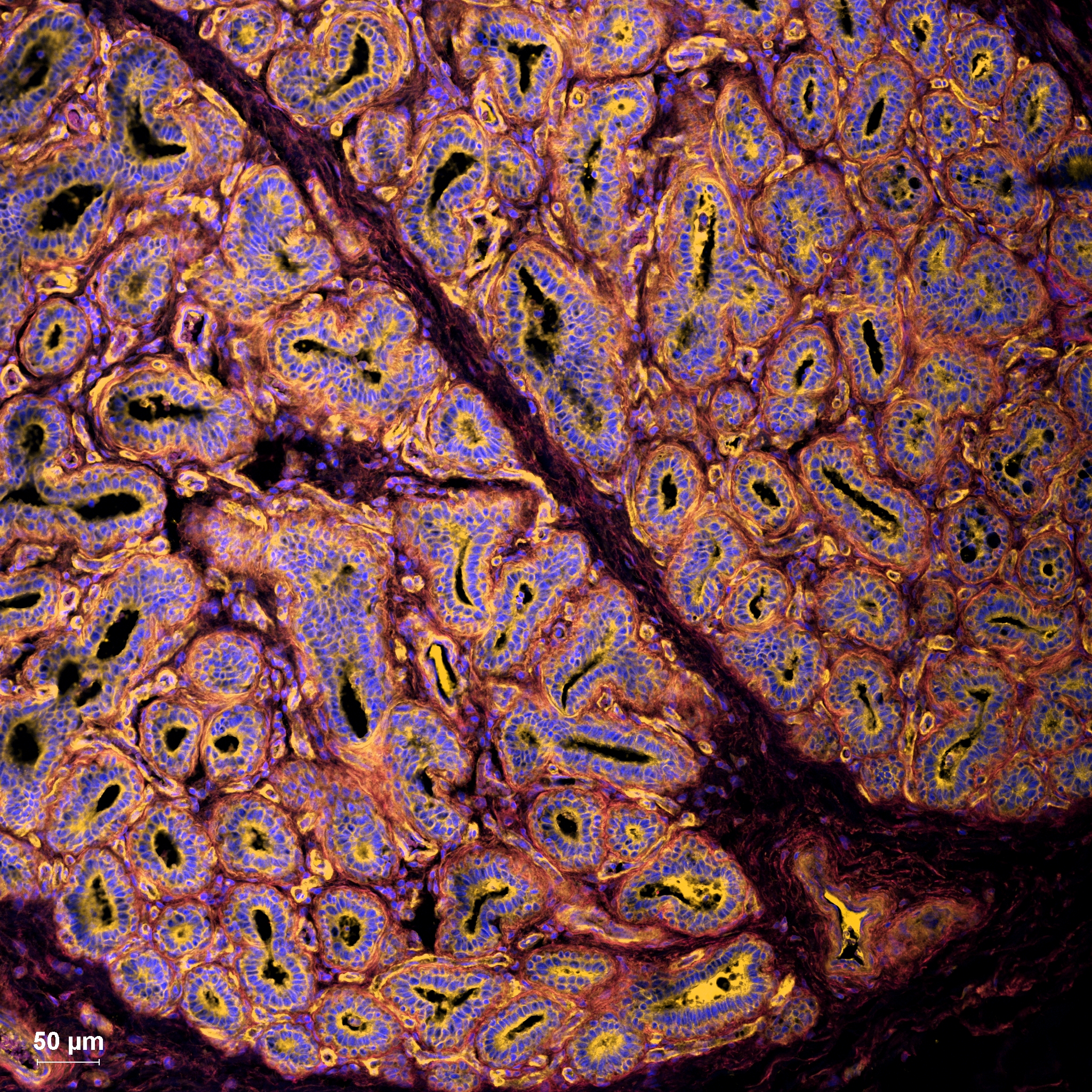 Microscopic image of bovine mammary gland tissue showing influenza virus receptors (yellow) on mammary epithelial cells. The study identified receptor patterns that may help explain the susceptibility of the bovine mammary gland to H5N1 infection and its ability to support viral replication. Microscopic image of bovine mammary gland tissue showing influenza virus receptors (yellow) on mammary epithelial cells. The study identified receptor patterns that may help explain the susceptibility of the bovine mammary gland to H5N1 infection and its ability to support viral replication.