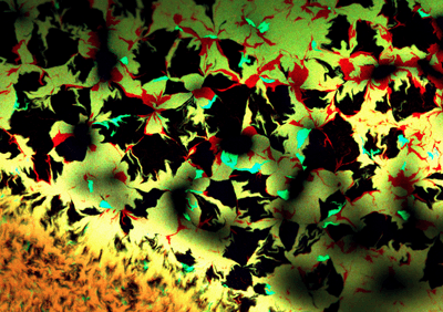 Confocal micrograph of Escherichia coli