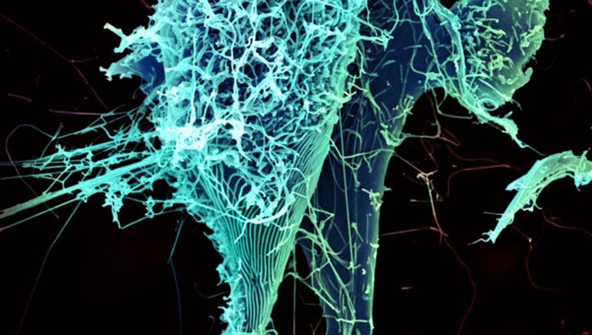 Ebola Ebola Outbreak Exceeds 1,000 Cases, And Is Detected In France And Uganda