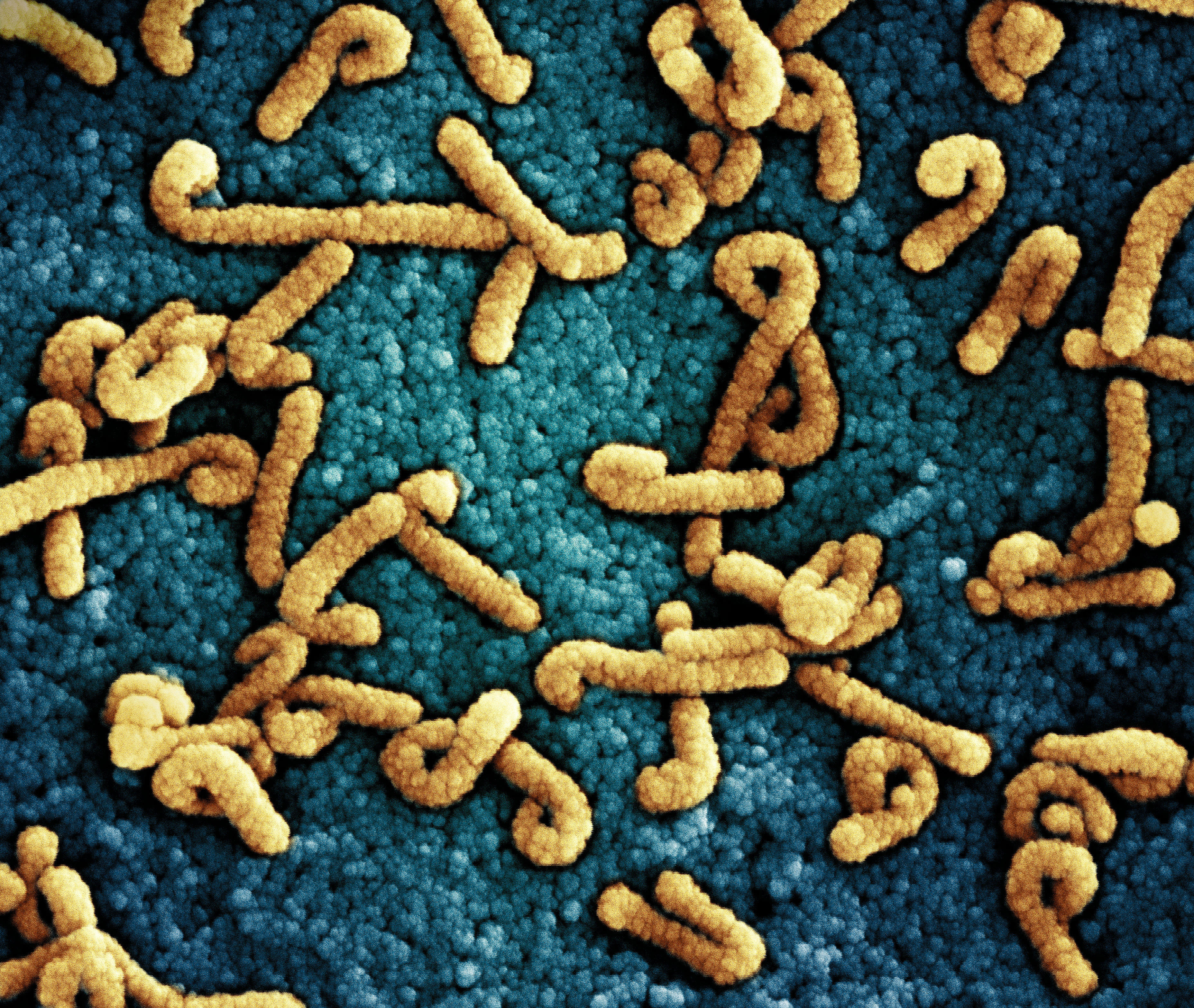 Colorized scanning electron micrograph of Marburg virus particles (yellow) both budding and attached to the surface of an infected VERO E6 cell (blue). Image captured at the NIAID Integrated Research Facility in Fort Detrick, Maryland. Credit: NIAID