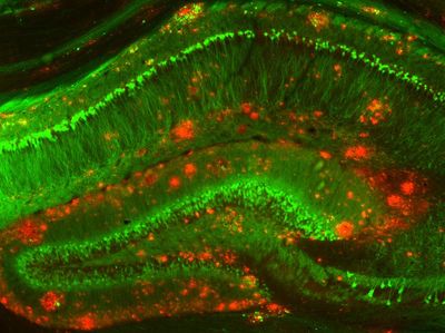 A microscope image of a mouse brain model of alzheimers, showing amyloid plaques in red