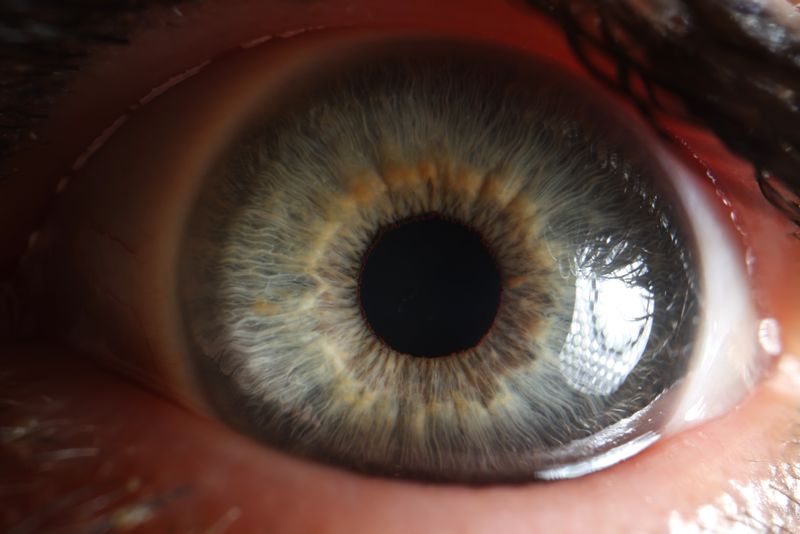 A close up picture of an eye.